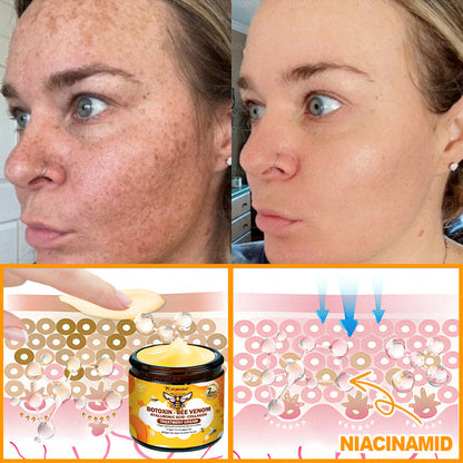 🔥 🗽🔥Made & Shipped from USA | Clinically Proven: PUROSA® Bee Venom Treatment Cream with bee venom peptides, botulinum toxin, hyaluronic acid, and collagen💧. Targets wrinkles, fine lines, sagging, stretch marks, dark spots—firming, lifting and more