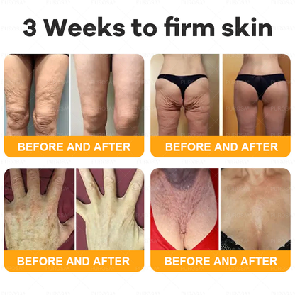 🔥 🗽🔥Made & Shipped from USA | Clinically Proven: PUROSA® Bee Venom Treatment Cream with bee venom peptides, botulinum toxin, hyaluronic acid, and collagen💧. Targets wrinkles, fine lines, sagging, stretch marks, dark spots—firming, lifting and more