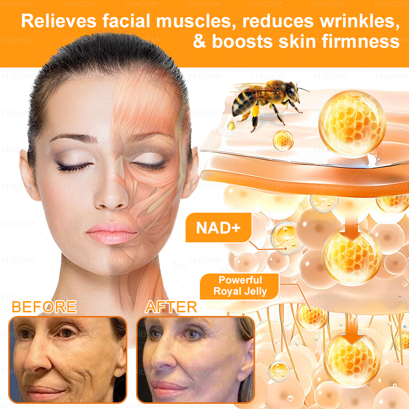 🔥 🗽🔥Made & Shipped from USA | Clinically Proven: PUROSA® Bee Venom Treatment Cream with bee venom peptides, botulinum toxin, hyaluronic acid, and collagen💧. Targets wrinkles, fine lines, sagging, stretch marks, dark spots—firming, lifting and more